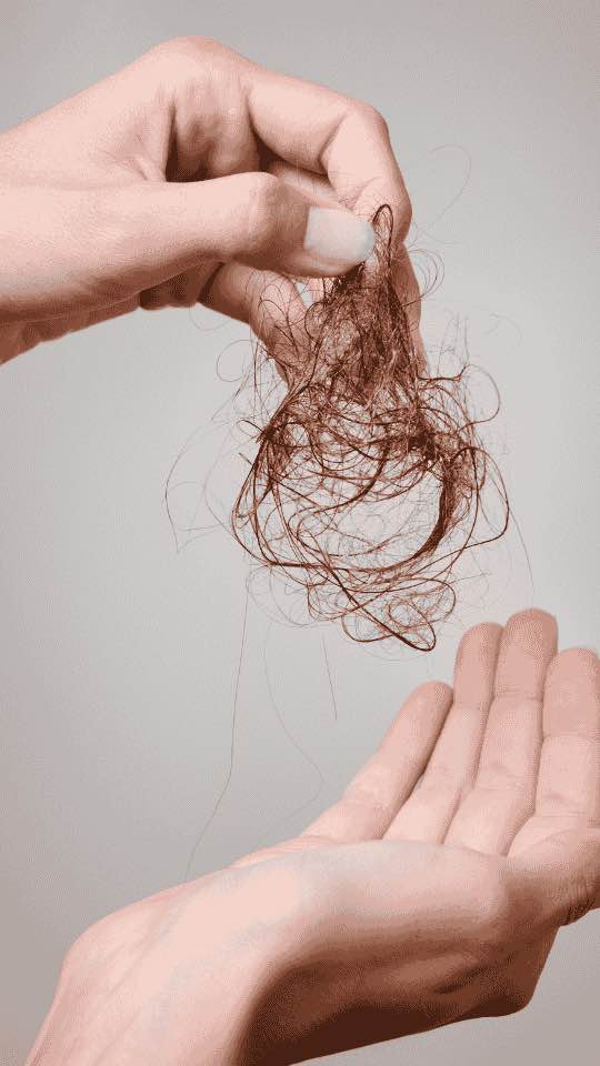 Stress Bisa Buat Rambut Rontok? ini Solusi Penebal Rambutnya