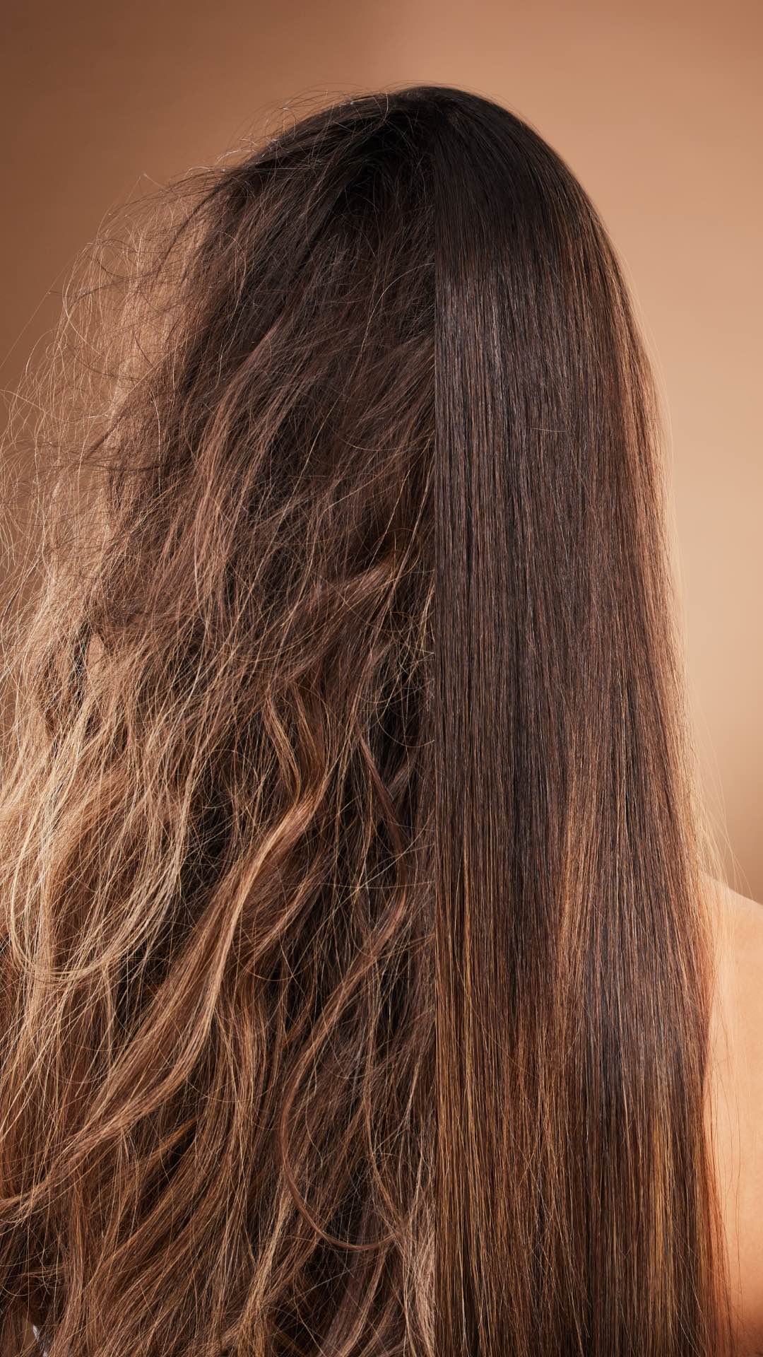 Apakah Rambut Tipis Itu Normal?