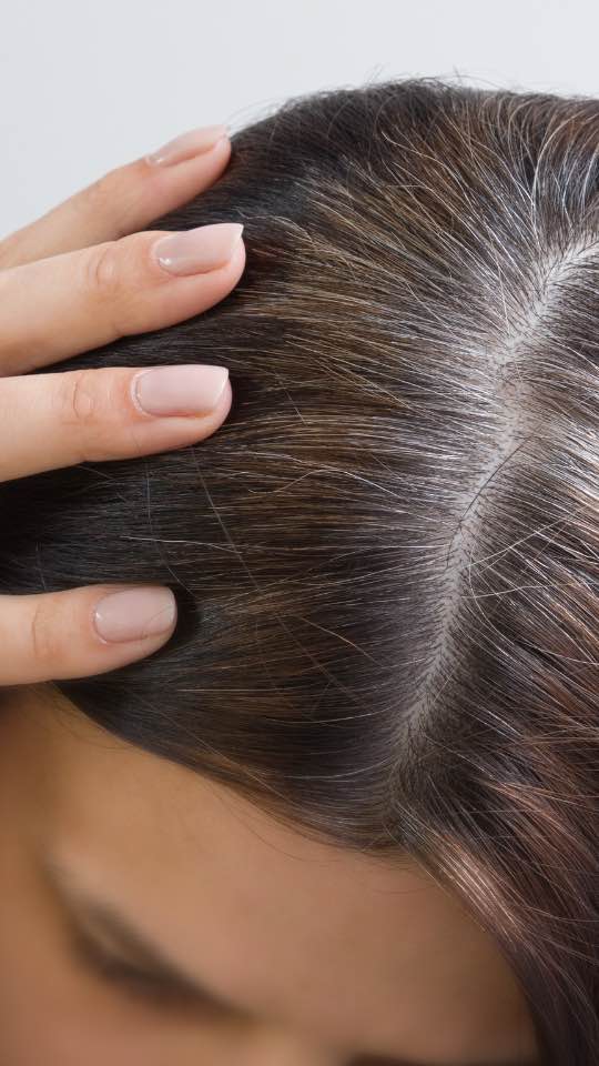 Kurang Nutrisi Bisa Buat Rambut Menipis? Ini Faktanya !